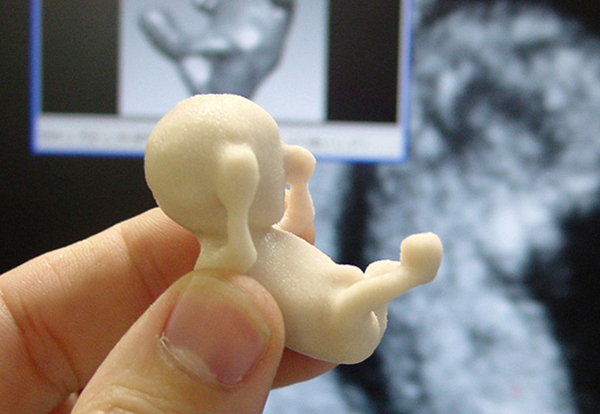 unborn-child-3d-print.jpg